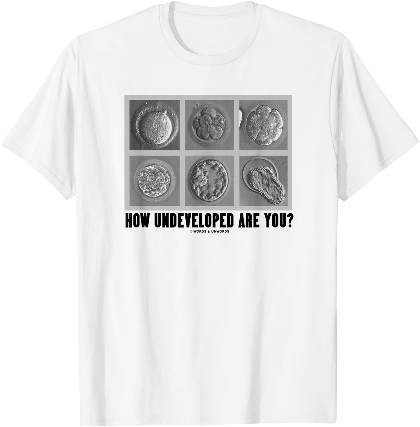 How Undeveloped Are You? Embryos Zygotes Embryology Humor T-Shirt - T-Shirt | White