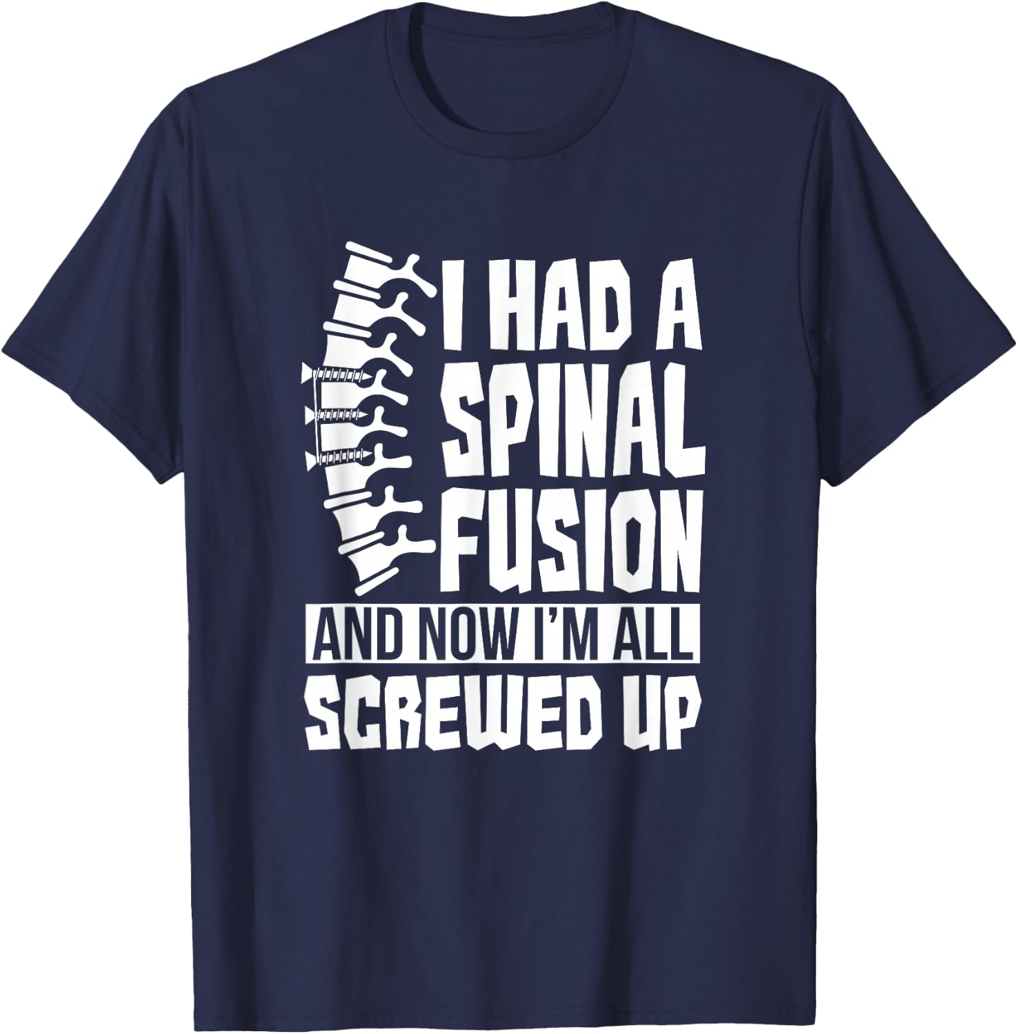 Spinal Fusion All Screwed Up - Spine Surgery Survivor Gift T-Shirt - T-Shirt | Navy